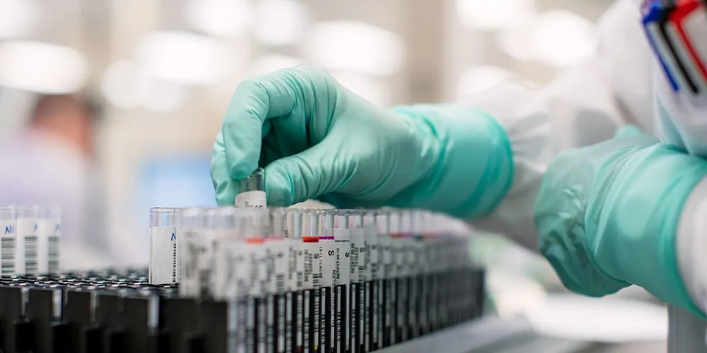 گرایش های رشته میکروبیولوژی