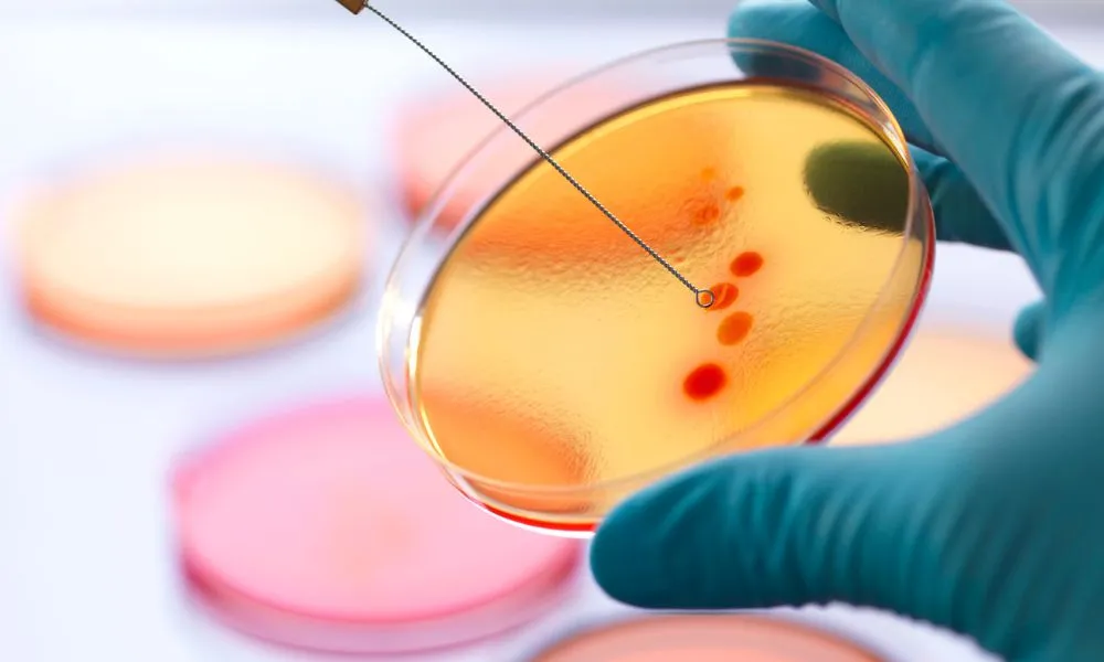 گرایش های رشته میکروبیولوژی